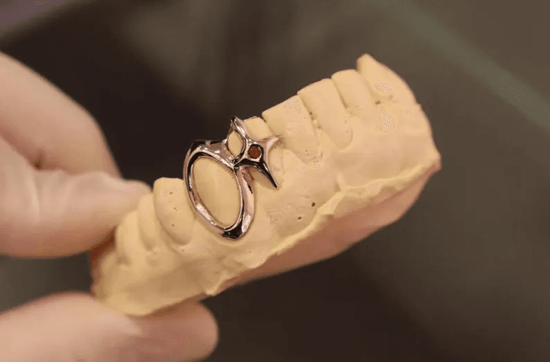 Customize Grillz to Elevate you teeth Game. thumbnail 2